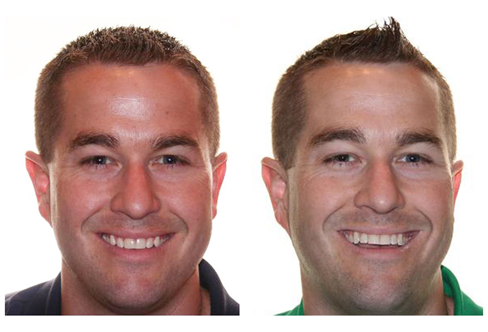 Aaron Dental   Orthodontics