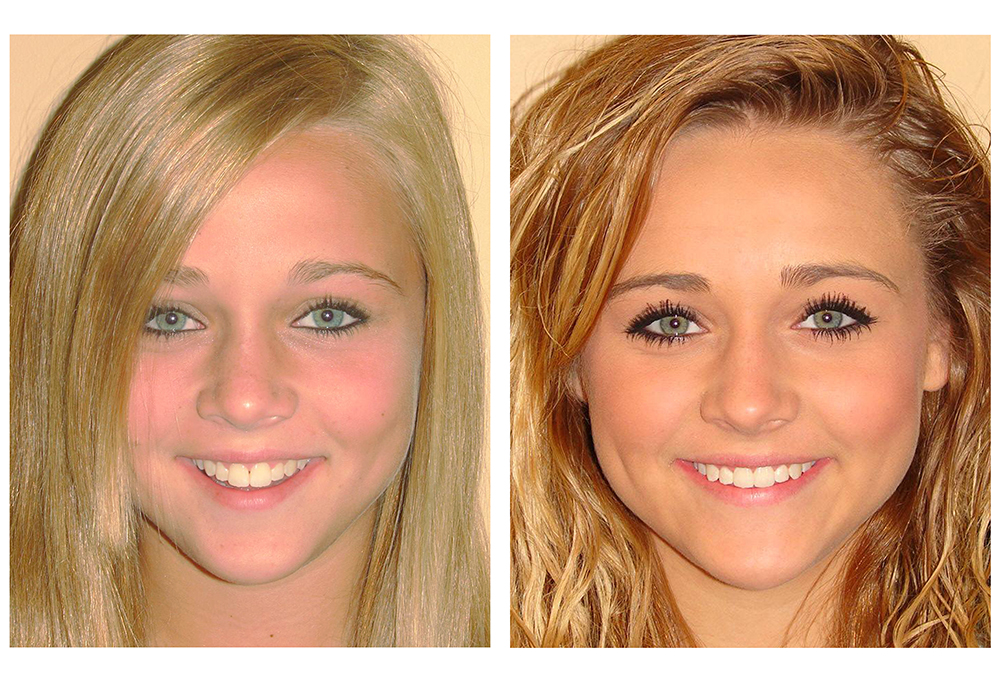 Aaron Dental   Orthodontics